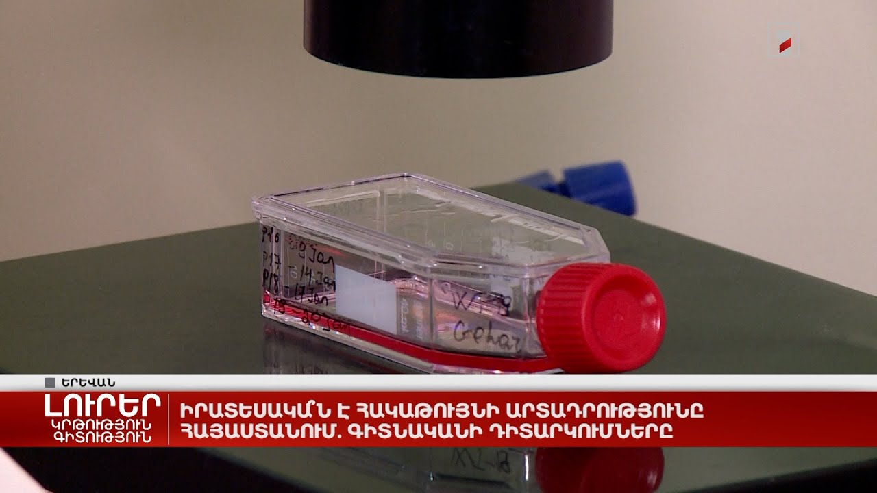 Պարզապես Կայքի Պահպանման Գործընթաց է